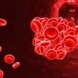 ĐÔNG MÁU RẢI RÁC TRONG LÒNG MẠCH (Diseminated Intravascular Coagulation: DIC)